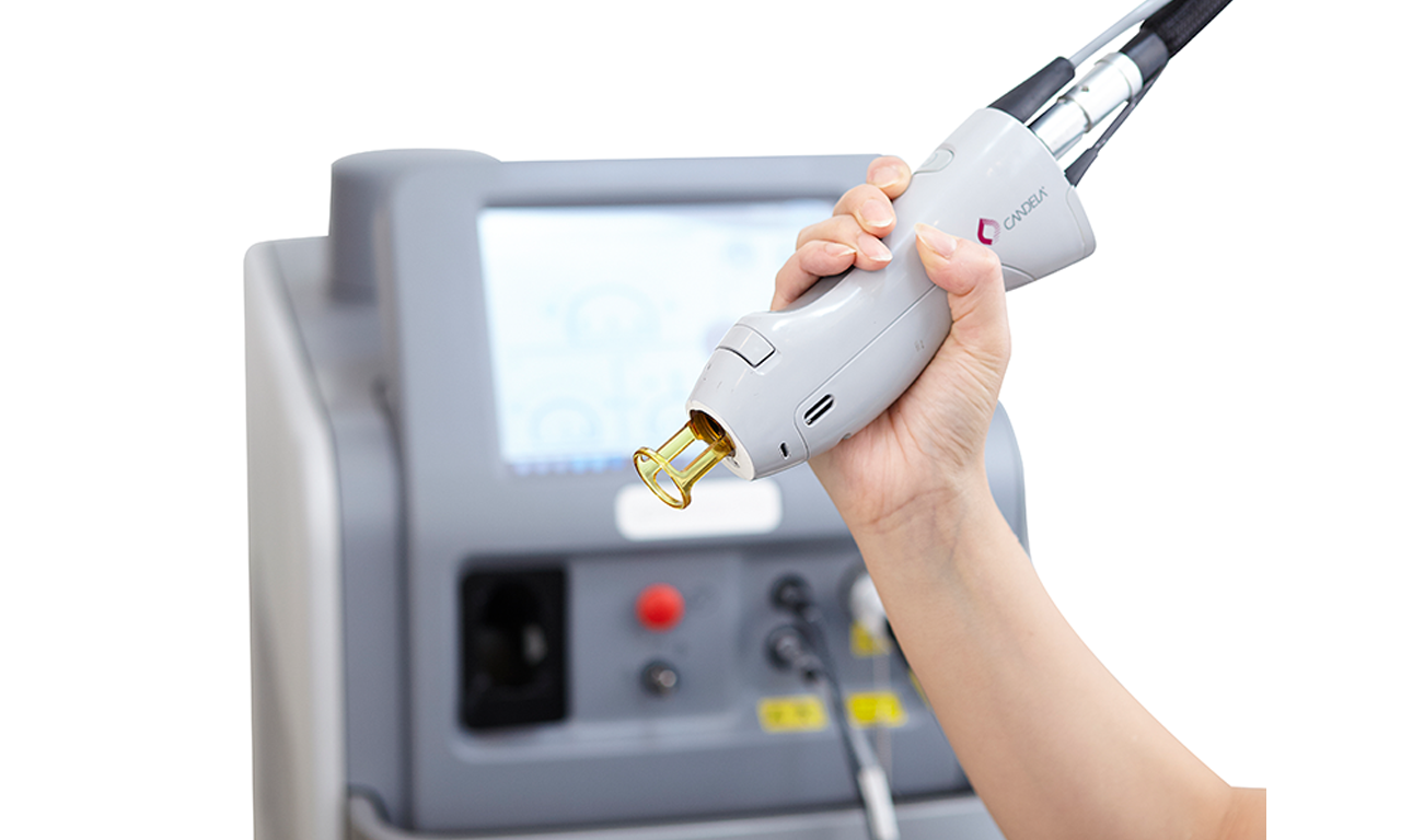 医療脱毛の治療写真