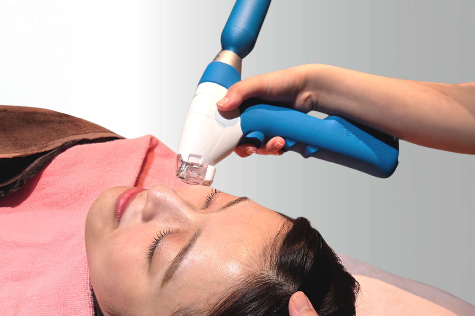 アイスニードリングの治療写真