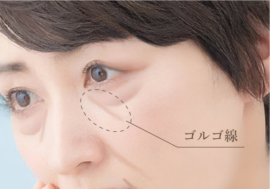 ゴルゴ線のイメージイラスト画像